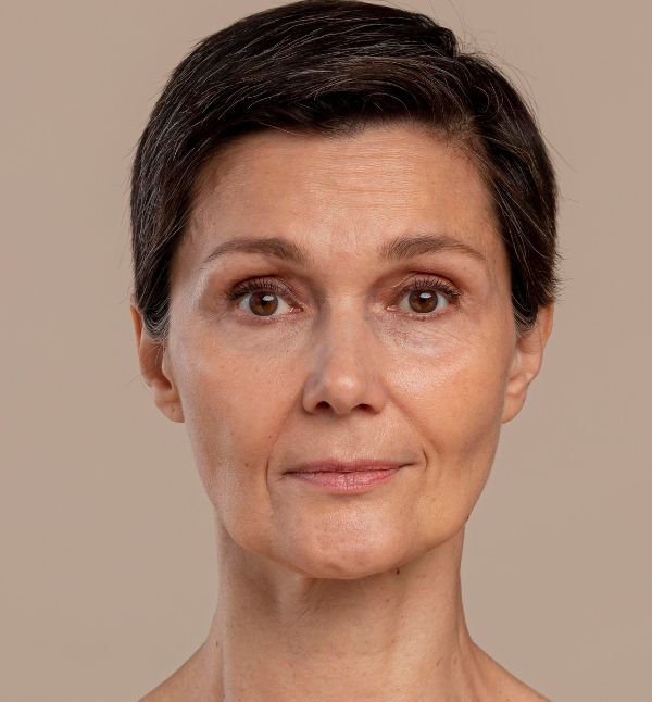Before-facefour